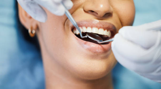 Best Emergency Root Canal Therapy in Christiansburg, VA