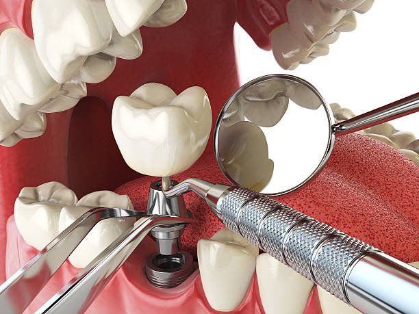 Best Emergency Orthodontic Repairs in Christiansburg, VA